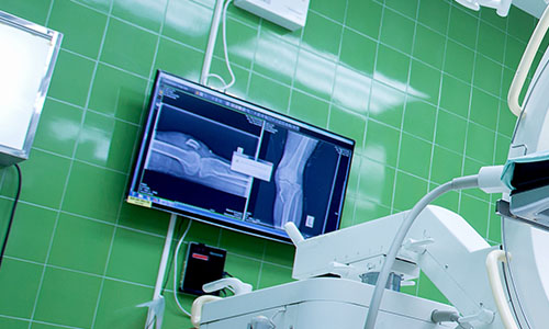 Operating Theatre Gas Struts & Dampers Operating Threatre Arms - Operating Theatre Gas Struts & Dampers